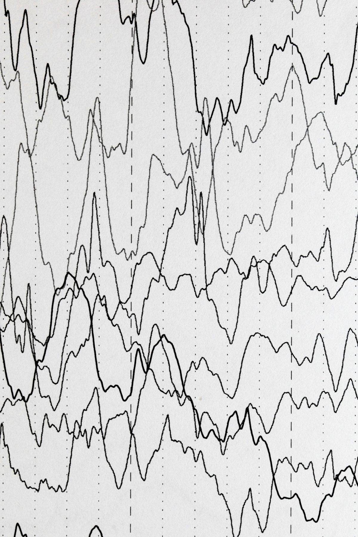 Brain waves measured.